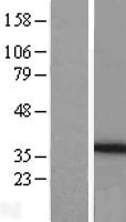 PEX26 Protein - Western validation with an anti-DDK antibody * L: Control HEK293 lysate R: Over-expression lysate