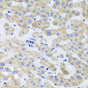 PEX3 Antibody - Immunohistochemistry of paraffin-embedded human liver injury tissue.