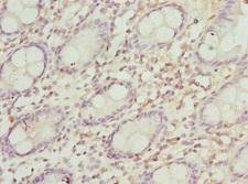 PEX3 Antibody - Immunohistochemistry of paraffin-embedded human human rectum tissue at dilution 1:100