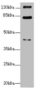 PEX3 Antibody - Western blot All Lanes:PEX3 antibody at 1.11ug/ml +Mouse kidney tissue Goat polyclonal to rabbit at 1/10000 dilution Predicted band size: 42 kDa Observed band size: 42,82,125 kDa