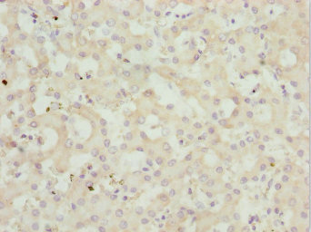 PEX3 Antibody - Immunohistochemistry of paraffin-embedded human liver tissue at dilution 1:100