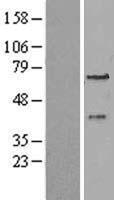 PEX3 Protein - Western validation with an anti-DDK antibody * L: Control HEK293 lysate R: Over-expression lysate