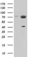 PEX5 Antibody - HEK293T cells were transfected with the pCMV6-ENTRY control (Left lane) or pCMV6-ENTRY PEX5 (Right lane) cDNA for 48 hrs and lysed. Equivalent amounts of cell lysates (5 ug per lane) were separated by SDS-PAGE and immunoblotted with anti-PEX5.