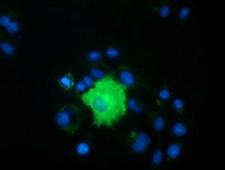 PEX5 Antibody - Anti-PEX5 mouse monoclonal antibody  immunofluorescent staining of COS7 cells transiently transfected by pCMV6-ENTRY PEX5.