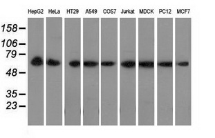 PEX5 Antibody - Western blot of extracts (35 ug) from 9 different cell lines by using anti-PEX5 monoclonal antibody.