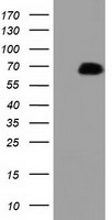 PEX5 Antibody - HEK293T cells were transfected with the pCMV6-ENTRY control (Left lane) or pCMV6-ENTRY PEX5 (Right lane) cDNA for 48 hrs and lysed. Equivalent amounts of cell lysates (5 ug per lane) were separated by SDS-PAGE and immunoblotted with anti-PEX5.