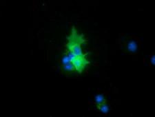 PEX5 Antibody - Anti-PEX5 mouse monoclonal antibody  immunofluorescent staining of COS7 cells transiently transfected by pCMV6-ENTRY PEX5.