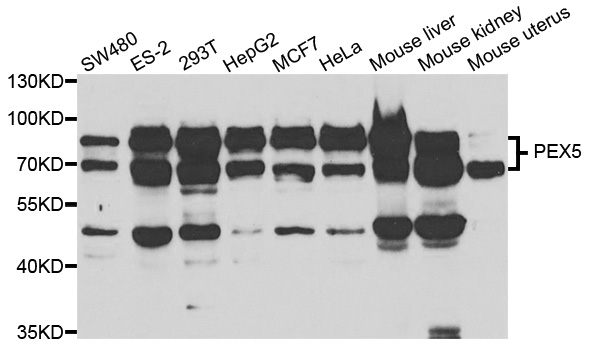 PEX5 Antibody - Western blot analysis of extracts of various cell lines.