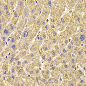 PEX5 Antibody - Immunohistochemistry of paraffin-embedded human liver injury tissue.