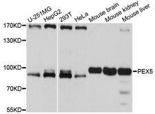 PEX5 Antibody - Western blot analysis of extracts of various cell lines, using PEX5 antibody at 1:1000 dilution. The secondary antibody used was an HRP Goat Anti-Rabbit IgG (H+L) at 1:10000 dilution. Lysates were loaded 25ug per lane and 3% nonfat dry milk in TBST was used for blocking. An ECL Kit was used for detection and the exposure time was 10s.