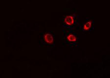 PEX5 Antibody - Staining HeLa cells by IF/ICC. The samples were fixed with PFA and permeabilized in 0.1% Triton X-100, then blocked in 10% serum for 45 min at 25°C. The primary antibody was diluted at 1:200 and incubated with the sample for 1 hour at 37°C. An Alexa Fluor 594 conjugated goat anti-rabbit IgG (H+L) antibody, diluted at 1/600, was used as secondary antibody.