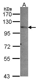 PEX6 Antibody - Sample (30 ug of whole cell lysate). A: A549. 7.5% SDS PAGE. PEX6 antibody diluted at 1:1000.