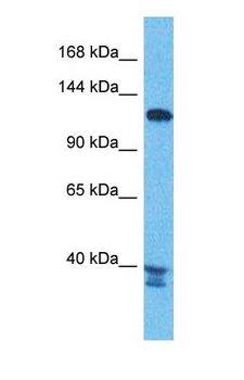 PEX6 Antibody - Western blot of PEX6 Antibody with human Jurkat Whole Cell lysate.  This image was taken for the unconjugated form of this product. Other forms have not been tested.