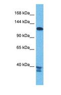PEX6 Antibody - Western blot of PEX6 Antibody with human Jurkat Whole Cell lysate.  This image was taken for the unconjugated form of this product. Other forms have not been tested.