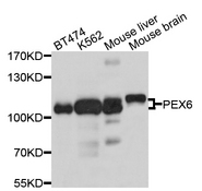 PEX6 Antibody - Western blot analysis of extracts of various cell lines, using PEX6 antibody at 1:1000 dilution. The secondary antibody used was an HRP Goat Anti-Rabbit IgG (H+L) at 1:10000 dilution. Lysates were loaded 25ug per lane and 3% nonfat dry milk in TBST was used for blocking. An ECL Kit was used for detection and the exposure time was 5s.