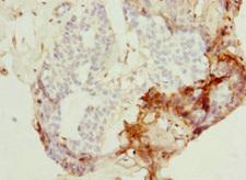 PEX7 Antibody - Immunohistochemistry of paraffin-embedded human breast cancer at dilution 1:100