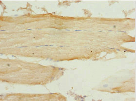 PEX7 Antibody - Immunohistochemistry of paraffin-embedded human skeletal muscle tissue at dilution 1:100