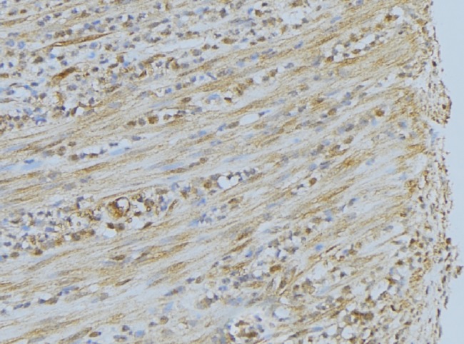 PEX7 Antibody - 1:100 staining mouse muscle tissue by IHC-P. The sample was formaldehyde fixed and a heat mediated antigen retrieval step in citrate buffer was performed. The sample was then blocked and incubated with the antibody for 1.5 hours at 22°C. An HRP conjugated goat anti-rabbit antibody was used as the secondary.