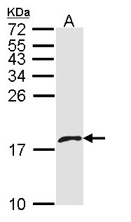 PF4V1 Antibody - Sample (30 ug of whole cell lysate). A: A431 . 15% SDS PAGE. PF4V1 antibody diluted at 1:1000.