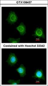 PF4V1 Antibody - Immunofluorescence of methanol-fixed HeLa using PF4V1 antibody at 1:200 dilution.