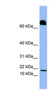 PF4V1 Antibody - PF4V1 antibody Western blot of PANC1 cell lysate. This image was taken for the unconjugated form of this product. Other forms have not been tested.
