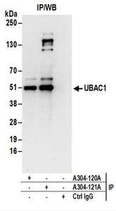 PFAS Antibody - Detection of Human PFAS by Western Blot. Samples: Whole cell lysate (50 ug) from Jurkat, HeLa, and 293T cells. Antibodies: Affinity purified rabbit anti-PFAS antibody used for WB at 0.1 ug/ml. Detection: Chemiluminescence with an exposure time of 3 minutes.