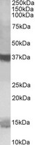 PFDN1 Antibody - Goat Anti-Prefoldin Antibody (1µg/ml) staining of K562 lysate (35µg protein in RIPA buffer). Primary incubation was 1 hour. Detected by chemiluminescencence.