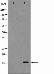 PFDN1 Antibody - Western blot analysis on RAW264.7 cell lysates using PFDN1 antibody. The lane on the left is treated with the antigen-specific peptide.