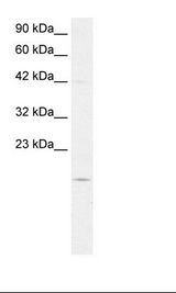 PFDN1 Antibody - HepG2 Cell Lysate.  This image was taken for the unconjugated form of this product. Other forms have not been tested.