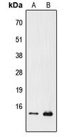 PFDN1 Antibody - Western blot analysis of PFDN1 expression in Jurkat (A); Raw264.7 (B) whole cell lysates.