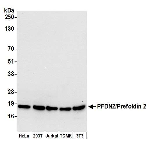 PFDN2 Antibody - Detection of human and mouse PFDN2/Prefoldin 2 by western blot. Samples: Whole cell lysate (50 µg) from HeLa, HEK293T, Jurkat, mouse TCMK-1, and mouse NIH 3T3 cells prepared using NETN lysis buffer. Antibody: Affinity purified rabbit anti-PFDN2/Prefoldin 2 antibody used for WB at 0.1 µg/ml. Detection: Chemiluminescence with an exposure time of 10 seconds.