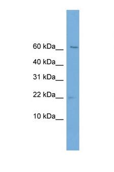 PFDN2 Antibody - PFDN2 antibody Western blot of Jurkat Cell lysate. Antibody concentration 1 ug/ml. This image was taken for the unconjugated form of this product. Other forms have not been tested.