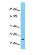 PFDN2 Antibody - Western blot of PFD2 Antibody with human Liver Tumor lysate.  This image was taken for the unconjugated form of this product. Other forms have not been tested.