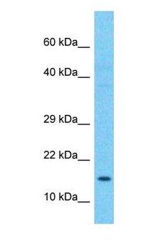 PFDN2 Antibody - Western blot of PFD2 Antibody with human Liver Tumor lysate.  This image was taken for the unconjugated form of this product. Other forms have not been tested.