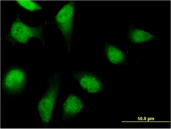 PFDN2 Antibody - Immunofluorescence of monoclonal antibody to PFDN2 on HeLa cell . [antibody concentration 10 ug/ml]