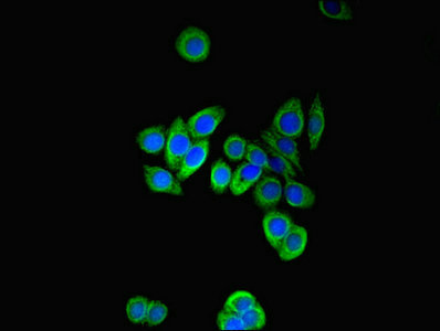 PFDN2 Antibody - Immunofluorescent analysis of PC-3 cells using PFDN2 Antibody at dilution of 1:100 and Alexa Fluor 488-congugated AffiniPure Goat Anti-Rabbit IgG(H+L)