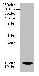 PFDN2 Antibody - Western blot All lanes: PFDN2 antibody at 6µg/ml + 293T whole cell lysate Secondary Goat polyclonal to rabbit IgG at 1/10000 dilution Predicted band size: 17 kDa Observed band size: 17 kDa