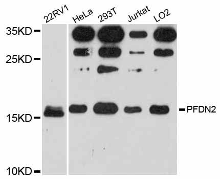 PFDN2 Antibody - Western blot analysis of extracts of various cell lines, using PFDN2 antibody at 1:3000 dilution. The secondary antibody used was an HRP Goat Anti-Rabbit IgG (H+L) at 1:10000 dilution. Lysates were loaded 25ug per lane and 3% nonfat dry milk in TBST was used for blocking. An ECL Kit was used for detection and the exposure time was 90s.