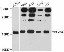 PFDN2 Antibody - Western blot analysis of extracts of various cell lines, using PFDN2 antibody at 1:3000 dilution. The secondary antibody used was an HRP Goat Anti-Rabbit IgG (H+L) at 1:10000 dilution. Lysates were loaded 25ug per lane and 3% nonfat dry milk in TBST was used for blocking. An ECL Kit was used for detection and the exposure time was 90s.