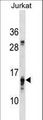 PFDN4 Antibody - PFDN4 Antibody western blot of Jurkat cell line lysates (35 ug/lane). The PFDN4 antibody detected the PFDN4 protein (arrow).