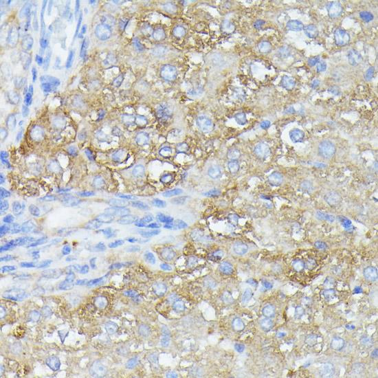 PFDN4 Antibody - Immunohistochemistry of paraffin-embedded Rat liver using PFDN4 Polyclonal Antibody at dilution of 1:100 (40x lens).