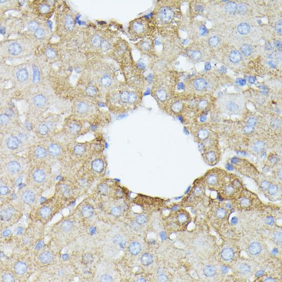 PFDN4 Antibody - Immunohistochemistry of paraffin-embedded Mouse liver using PFDN4 Polyclonal Antibody at dilution of 1:100 (40x lens).