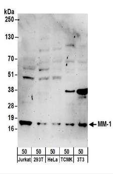 PFDN5 / MM1 Antibody - Detection of Human and Mouse MM-1 by Western Blot. Samples: Whole cell lysate (50 ug) from Jurkat, 293T, HeLa, mouse TCMK-1, and mouse NIH3T3 cells. Antibodies: Affinity purified rabbit anti-MM-1 antibody used for WB at 1 ug/ml. Detection: Chemiluminescence with an exposure time of 3 minutes.