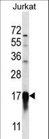 PFDN5 / MM1 Antibody - PFDN5 Antibody western blot of Jurkat cell line lysates (35 ug/lane). The PFDN5 antibody detected the PFDN5 protein (arrow).