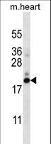 PFDN5 / MM1 Antibody - PFDN5 Antibody western blot of mouse heart tissue lysates (35 ug/lane). The PFDN5 antibody detected the PFDN5 protein (arrow).