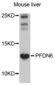 PFDN6 / HKE2 Antibody - Western blot analysis of extracts of mouse liver, using PFDN6 antibody at 1:1000 dilution. The secondary antibody used was an HRP Goat Anti-Rabbit IgG (H+L) at 1:10000 dilution. Lysates were loaded 25ug per lane and 3% nonfat dry milk in TBST was used for blocking. An ECL Kit was used for detection and the exposure time was 30s.