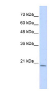 PFDN6 / HKE2 Antibody - PFDN6 antibody Western blot of Transfected 293T cell lysate. This image was taken for the unconjugated form of this product. Other forms have not been tested.