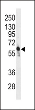 PFK2 / PFKFB3 Antibody - Western blot of anti-PFKFB3 Antibody in CEM cell line lysates (35 ug/lane). PFKFB3(arrow) was detected using the purified antibody.