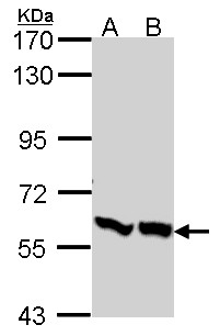 PFK2 / PFKFB3 Antibody - Sample (30 ug of whole cell lysate). A: A431 , B: H1299. 7.5% SDS PAGE. PFKFB3 antibody. PFK2 / PFKFB3 antibody diluted at 1:1000.