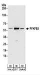 PFK2 / PFKFB3 Antibody - Detection of Human PFKFB3 by Western Blot. Samples: Whole cell lysate (50 ug) from HeLa, 293T, and Jurkat cells. Antibodies: Affinity purified rabbit anti-PFKFB3 antibody used for WB at 0.1 ug/ml. Detection: Chemiluminescence with an exposure time of 3 minutes.